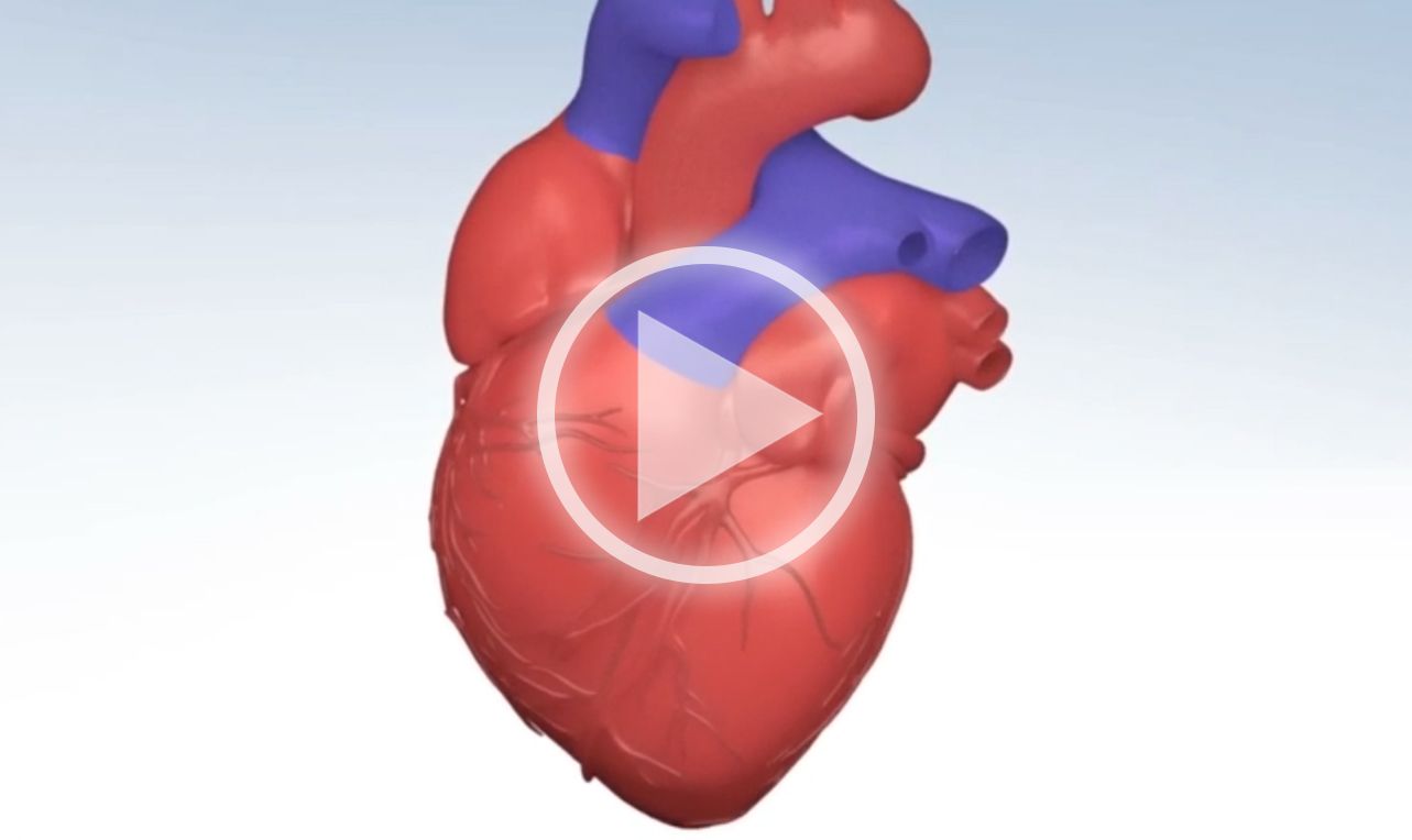 Tachycardia (TACH)